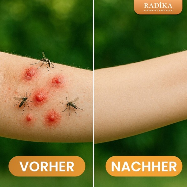 Insect repellent, to protect against mosquitoes, 100% pure, organic, natural, 100 ml
